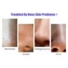 Blackhead Remover Instrument Black Dot Remover Acne Vacuum Suction Face Clean - Image 5